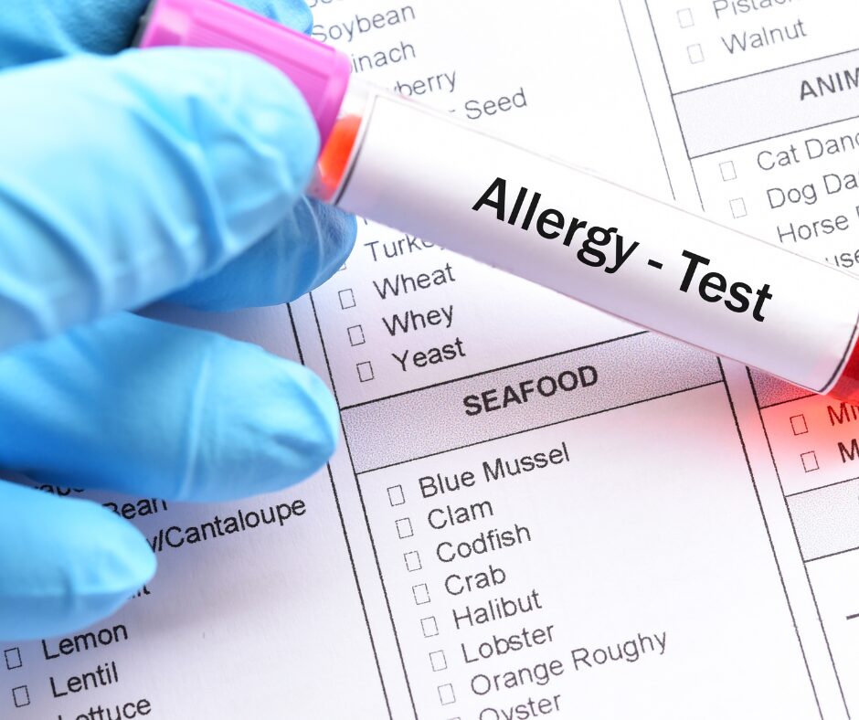 allergie test